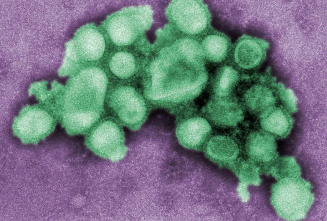 influenza járvány